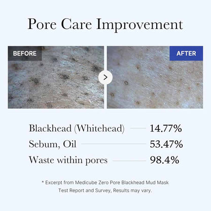 Medicube Zero Pore Blackhead Mud Facial Mask 100g