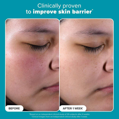 Paula's Choice 2% BHA Liquid Exfoliant