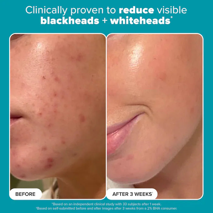 Paula's Choice 2% BHA Liquid Exfoliant
