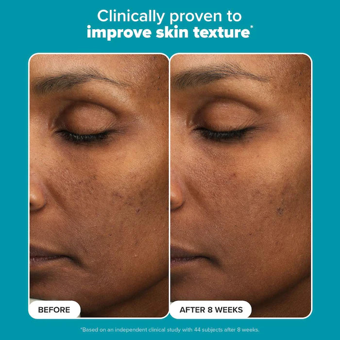 Paula's Choice 6% Mandelic Acid + 2% Lactic Acid Liquid Exfoliant