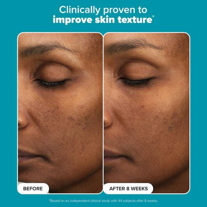 Paula's Choice 6% Mandelic Acid + 2% Lactic Acid Liquid Exfoliant